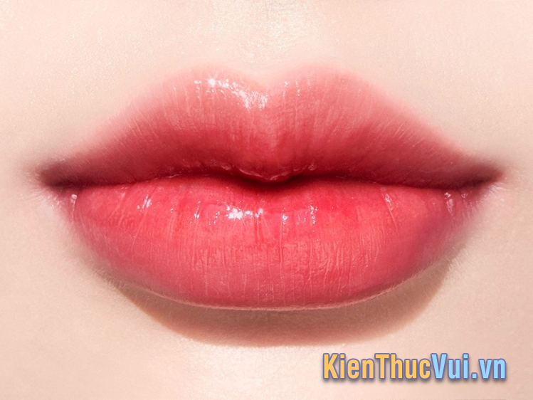 Dáng môi tiêm filler cherry
