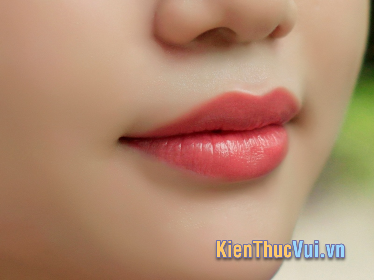 Dáng môi tiêm filler môi cười